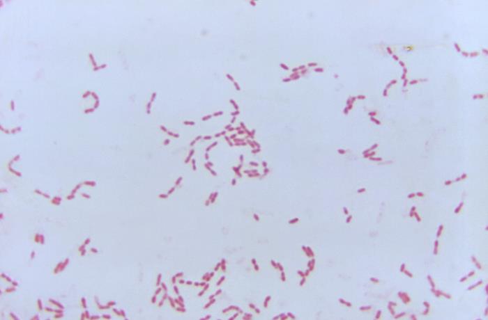 A micrograph of Gram-stained Yersinia pestis cells (1100X magnification). Image credit: PHIL 20848
